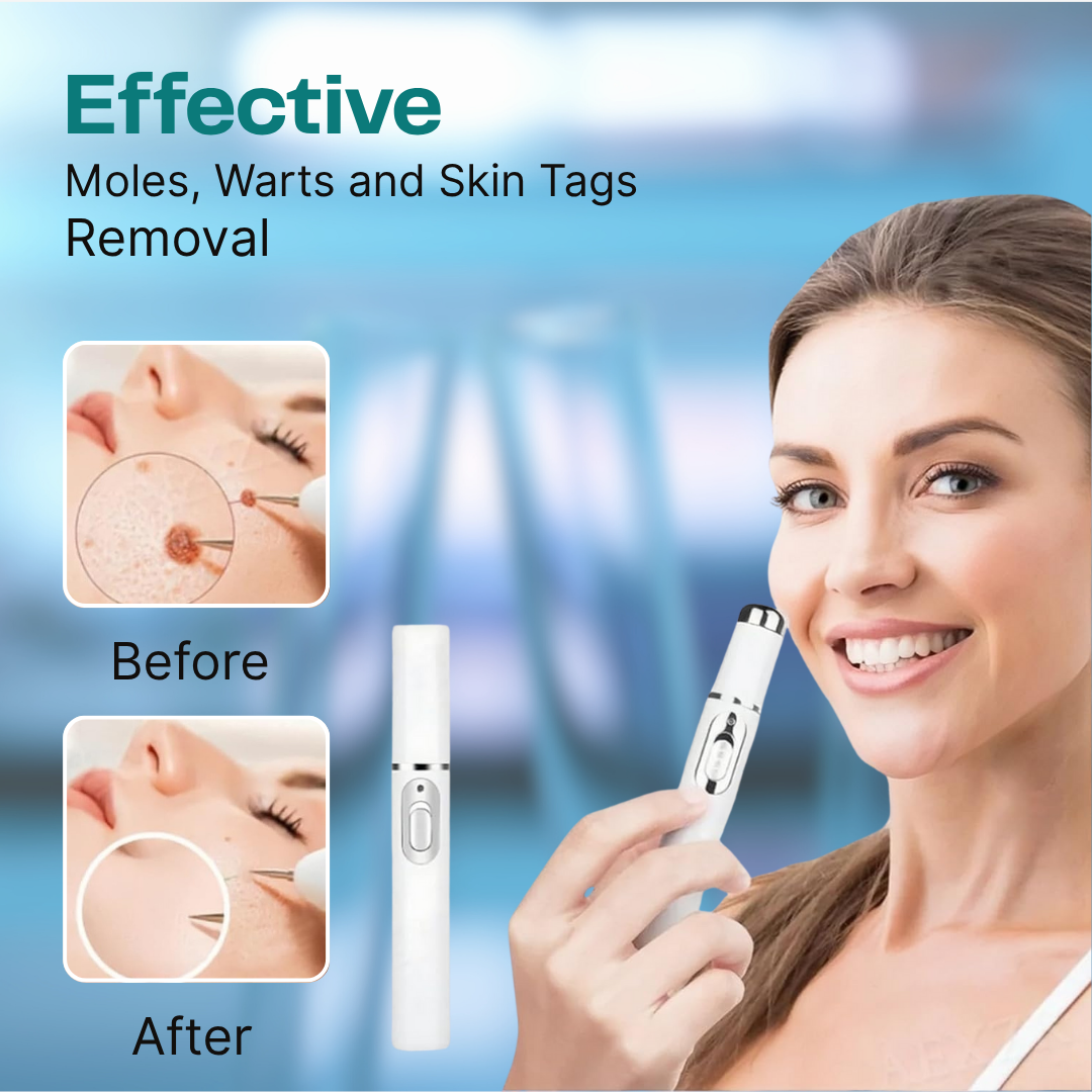 Non-Invasive Mole and Wart Removal Laser Pen